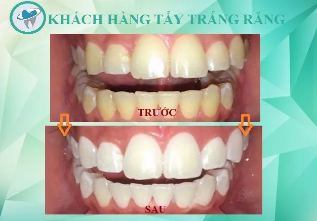 Hệ thống máy móc tiên tiến tại Nha khoa Nhân Tâm - Ảnh 2