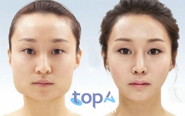 Bệnh viện Thái Thượng Hoàng Nghệ An - Địa chỉ vàng cho phẫu thuật hàm mặt