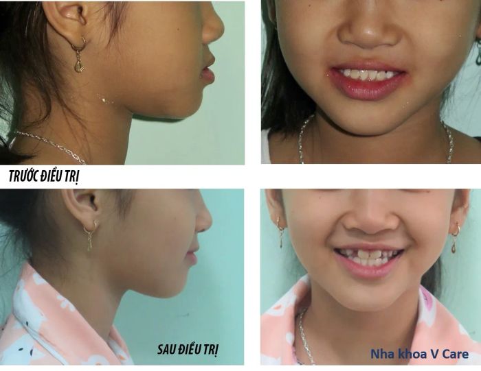 Hệ thống máy móc tiên tiến tại Nha Khoa Vcare - Ảnh 2