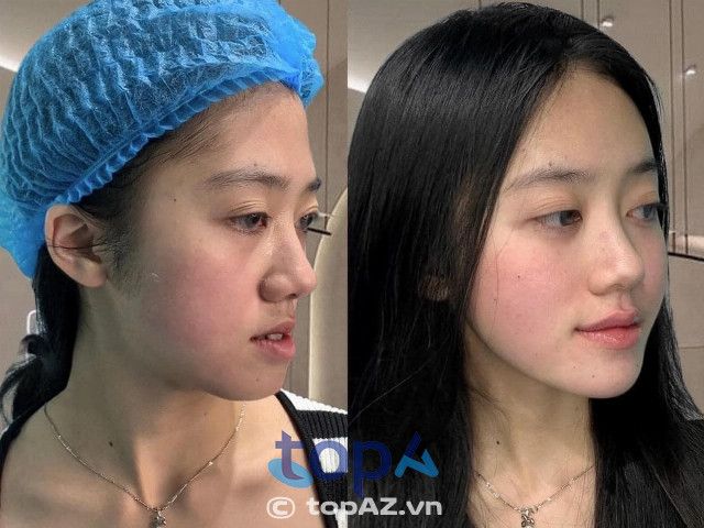 Thẩm mỹ viện Trần Trà - Địa chỉ vàng phẫu thuật hàm mặt tại Nghệ An