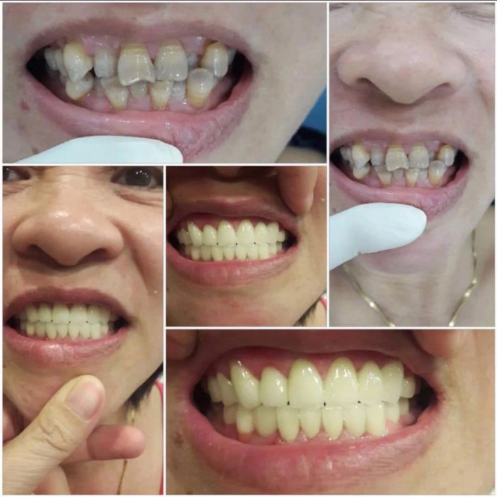 Hệ thống trang thiết bị tân tiến tại Nha Khoa Việt Mỹ - Ảnh 3