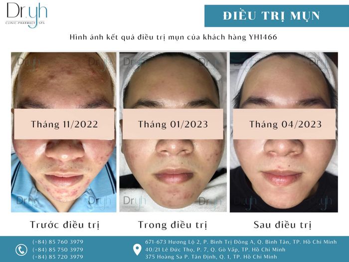 Hình ảnh kết quả điều trị ấn tượng tại DR.YH