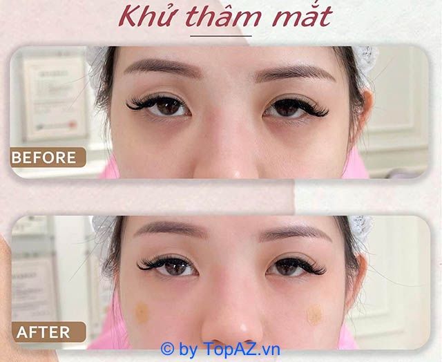 Địa chỉ spa làm đẹp uy tín tại TP. Mỹ Tho, Tiền Giang