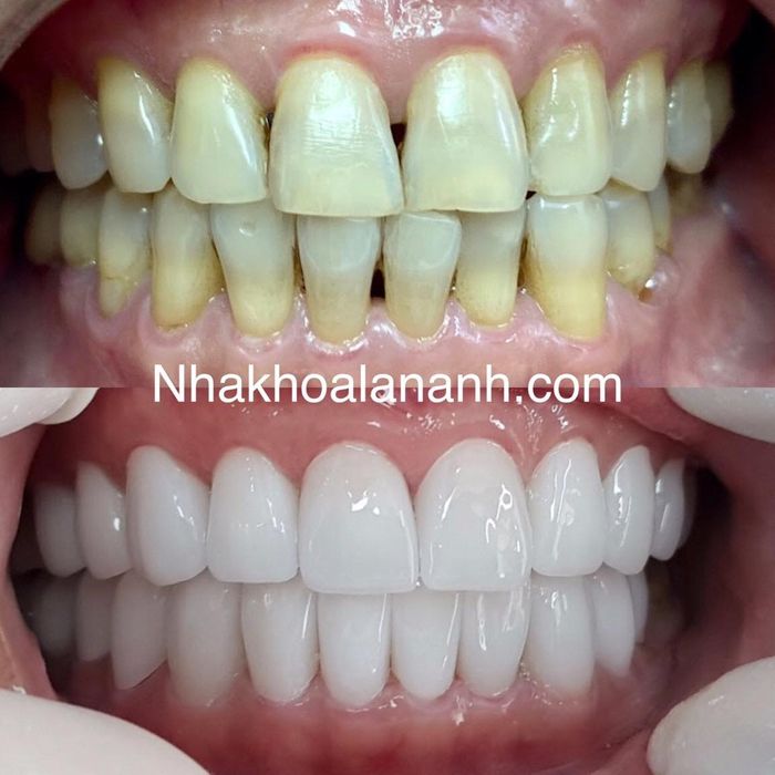 Nha Khoa Lan Anh - Hình ảnh 1