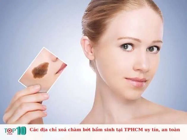 Danh sách những địa chỉ xóa chàm bớt bẩm sinh an toàn và uy tín nhất tại TP.HCM