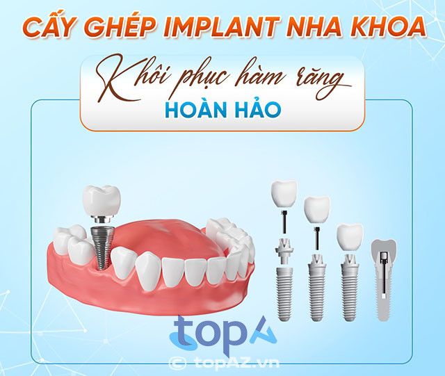 Nha khoa Song Mỹ Đà Lạt