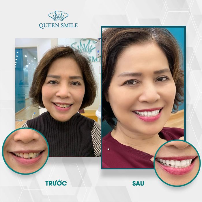 Hình ảnh Nha khoa thẩm mỹ Queen Smile 1