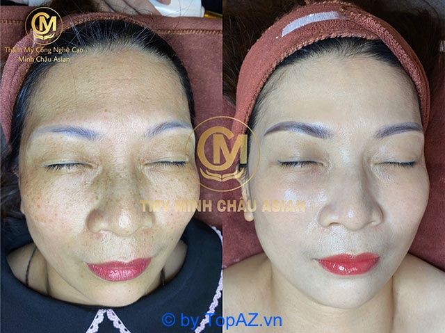 Các thẩm mỹ viện tại TP. Bảo Lộc, Lâm Đồng với mức giá phải chăng ngày càng trở nên phổ biến, đáp ứng nhu cầu làm đẹp của đông đảo khách hàng.