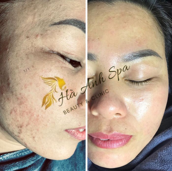 Hà Anh Beauty & Clinic ảnh 1