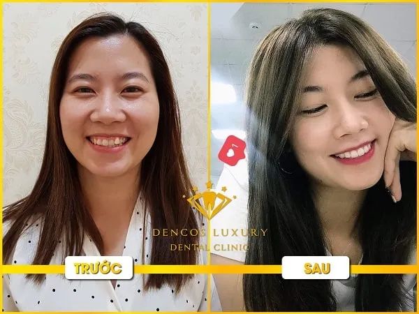 Hình ảnh Nha Khoa Quốc Tế Dencos Luxury 1