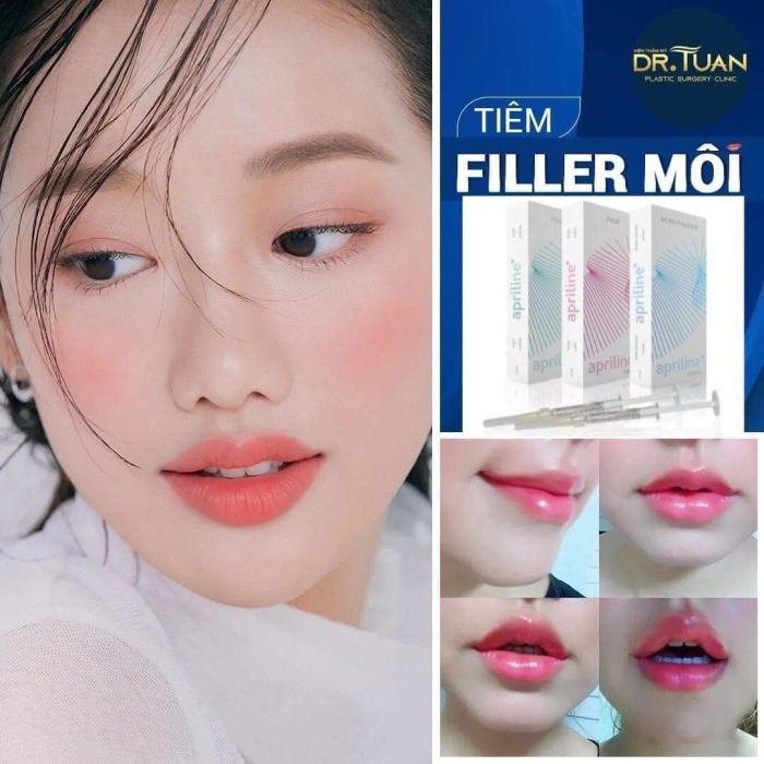 Quy trình tiêm filler chuẩn y khoa tại Viện Thẩm Mỹ Bs Tuấn