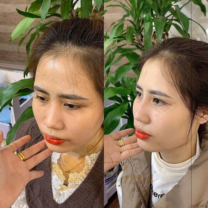 Hình ảnh thực tế dịch vụ tại Ami Beauty Clinic