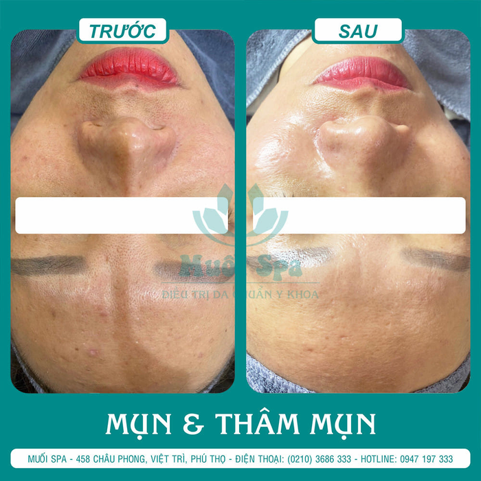Muối Spa ảnh 1