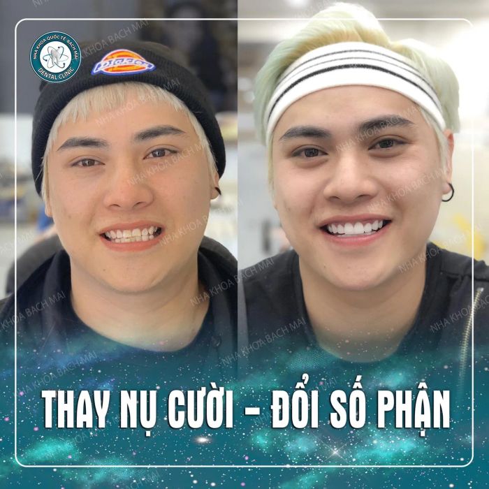Hình ảnh Nha Khoa Quốc Tế Bạch Mai 1