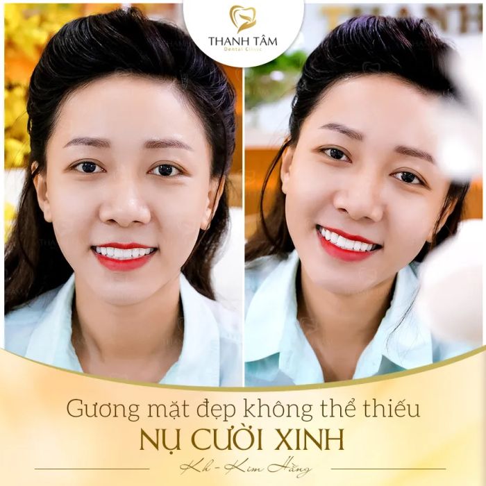 Không gian hiện đại và tiện nghi tại Nha Khoa Thanh Tâm