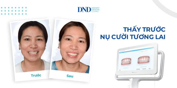 Hình ảnh Nha khoa Quốc tế DND 1