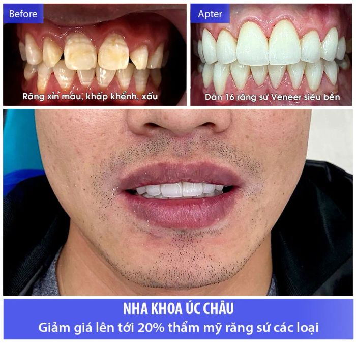 Hình ảnh Nha Khoa Úc Châu 1