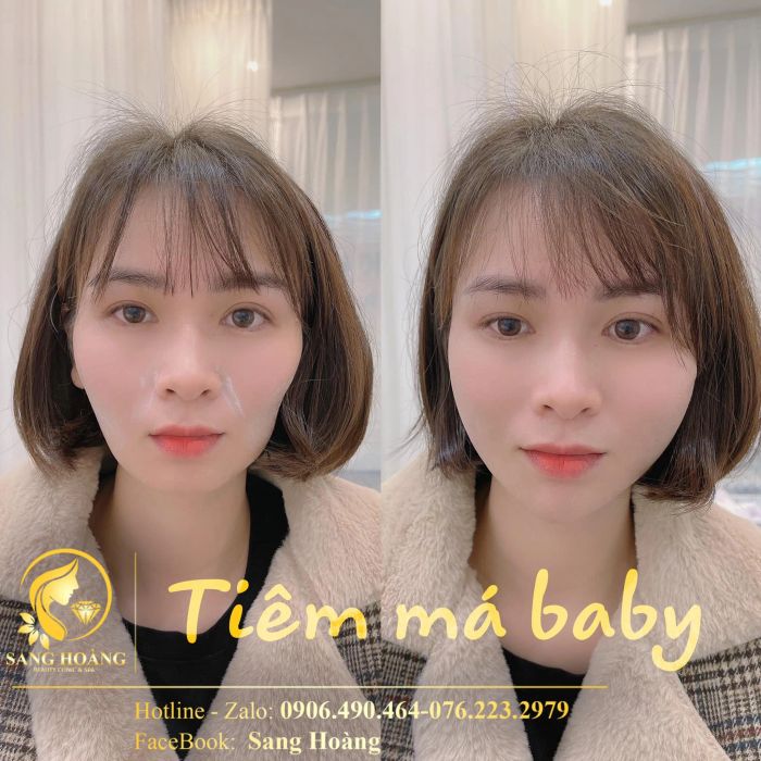 Hình ảnh thực tế tại Sang Hoàng Beauty Center