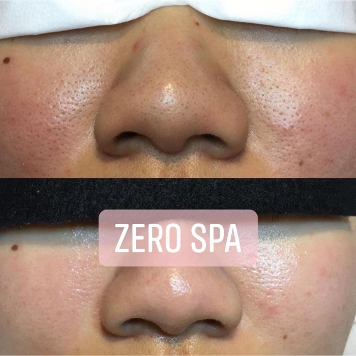 ZERO Spa ảnh 2