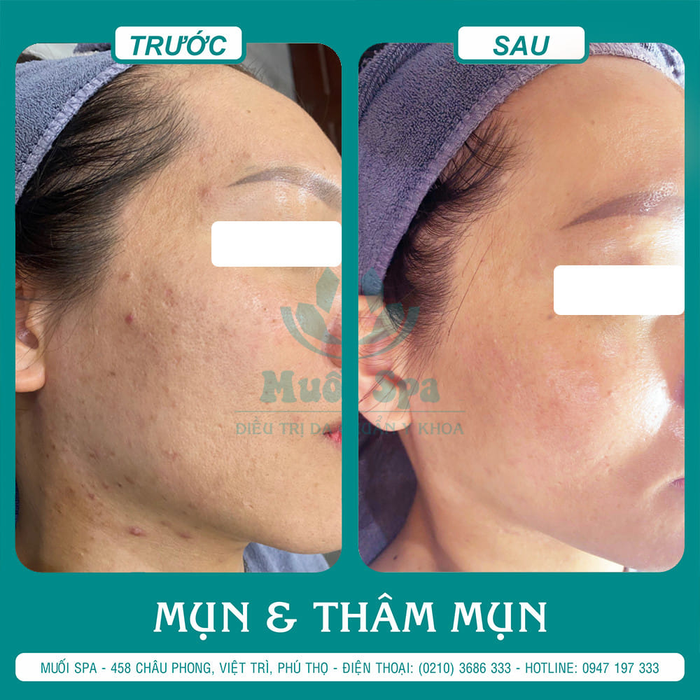 Muối Spa ảnh 2