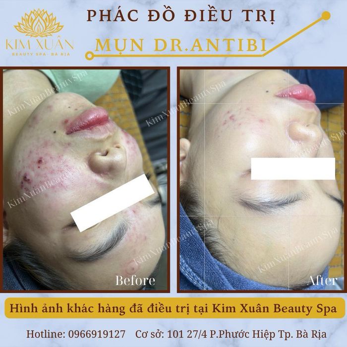 Hình ảnh Kim Xuân Beauty Spa 1