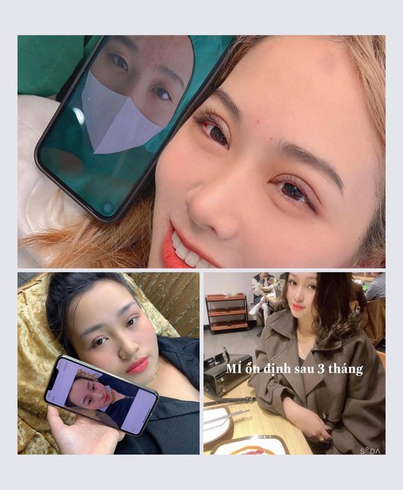 Hình ảnh Thẩm Mỹ Phương Thanh - Ảnh 2
