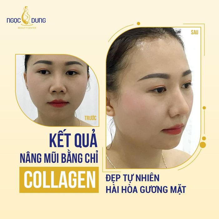 Hình ảnh Thẩm Mỹ Viện Ngọc Dung Hải Phòng - Ảnh 2