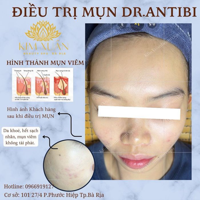 Hình ảnh Kim Xuân Beauty Spa 2