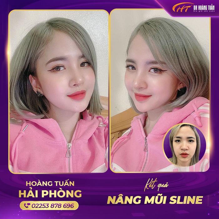 Thẩm mỹ Hoàng Tuấn - Hải Phòng hình ảnh 2