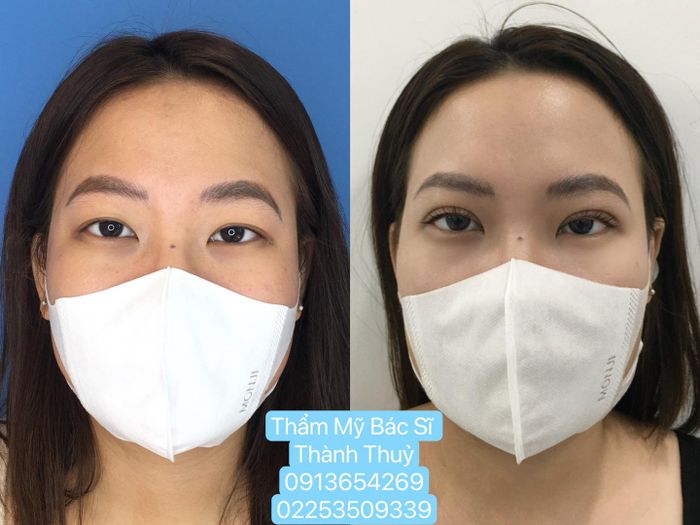 Hình ảnh Thẩm Mỹ Bác sĩ Thành Thủy - Ảnh 2