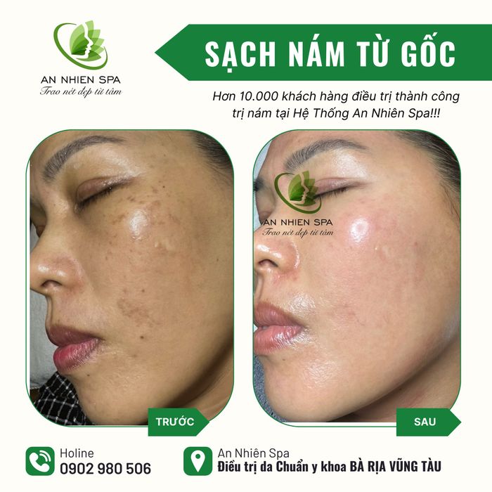 Hình ảnh Spa An Nhiên 2