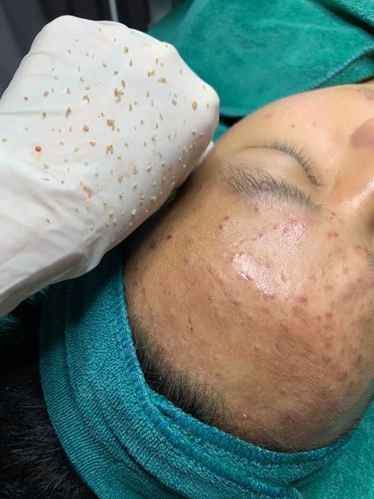 Bộ sưu tập hình ảnh dịch vụ tại Trang Spa