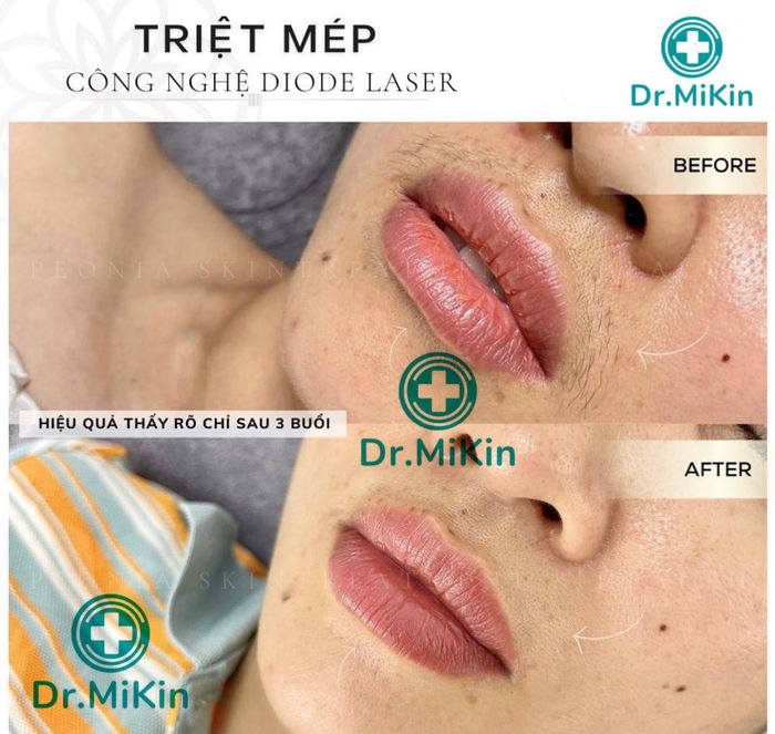 Không gian hiện đại và sang trọng tại Viện Thẩm Mỹ Dr. Mikin