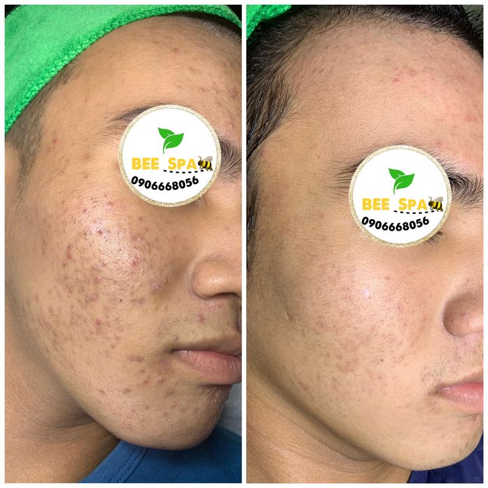 Góc thư giãn đẳng cấp tại Bee Spa - Ảnh 2