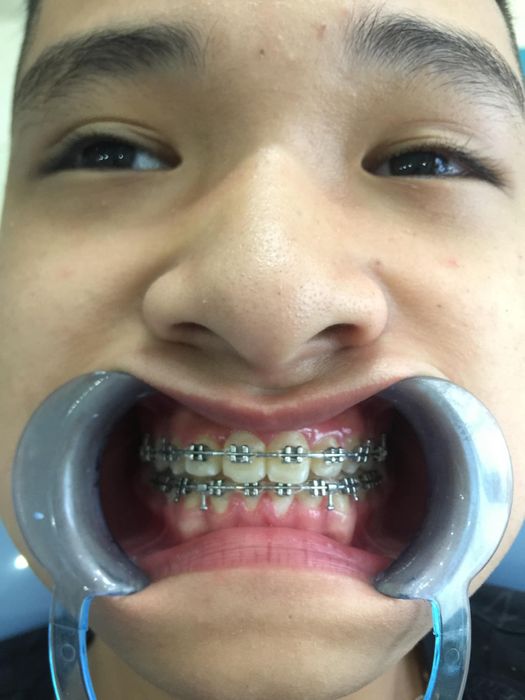 Nha Khoa Tâm Anh hình ảnh 2