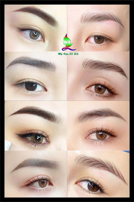 Hệ thống máy móc hiện đại đạt chuẩn Châu Âu tại Thẩm Mỹ Viện Hiha