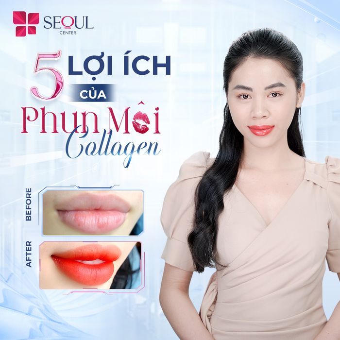 Không gian sang trọng và hiện đại tại Thẩm Mỹ Viện Seoul Center Hóc Môn