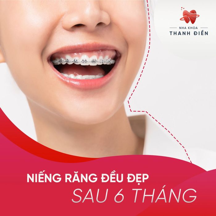 Nha Khoa Thẩm Mỹ Thanh Điền hình ảnh 1