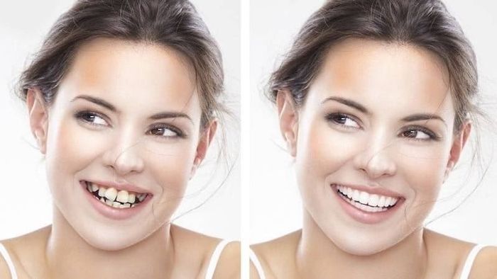 Nha Khoa Thẩm Mỹ Thanh Điền hình ảnh 2