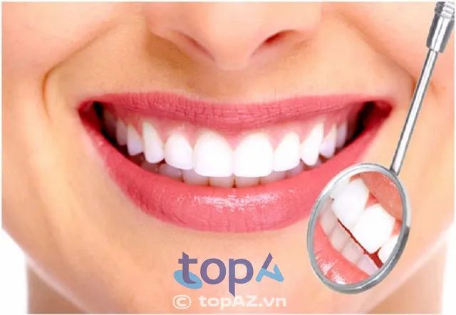 Địa chỉ bọc răng sứ chuẩn y khoa tại TP. Vinh