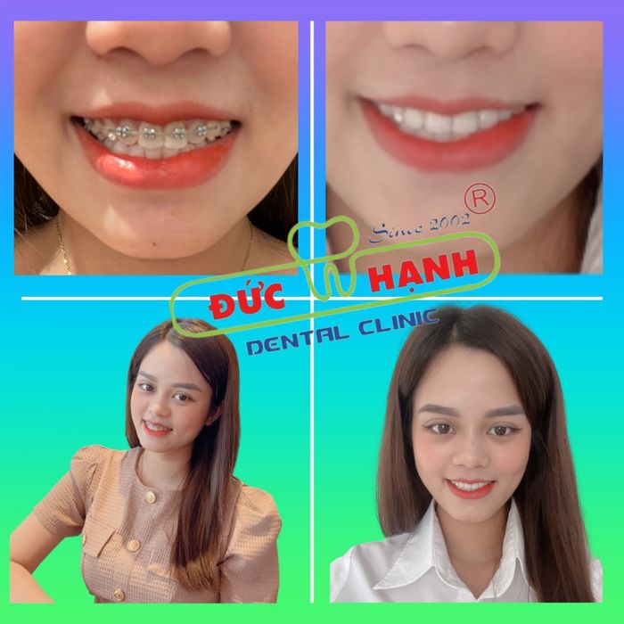 Nha Khoa Đức Hạnh hình ảnh 2