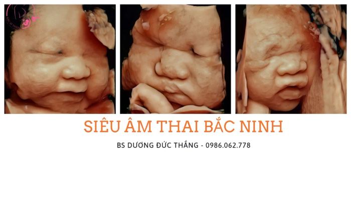 Hệ thống máy siêu âm hiện đại tại phòng khám