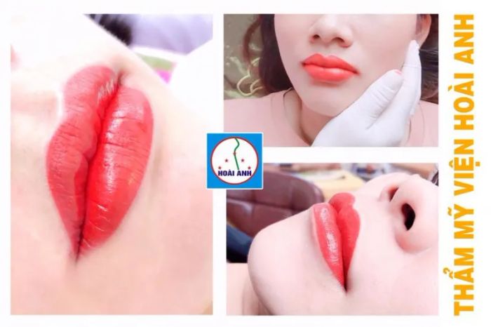 Không gian sang trọng và chuyên nghiệp tại Thẩm Mỹ Viện Hoài Anh