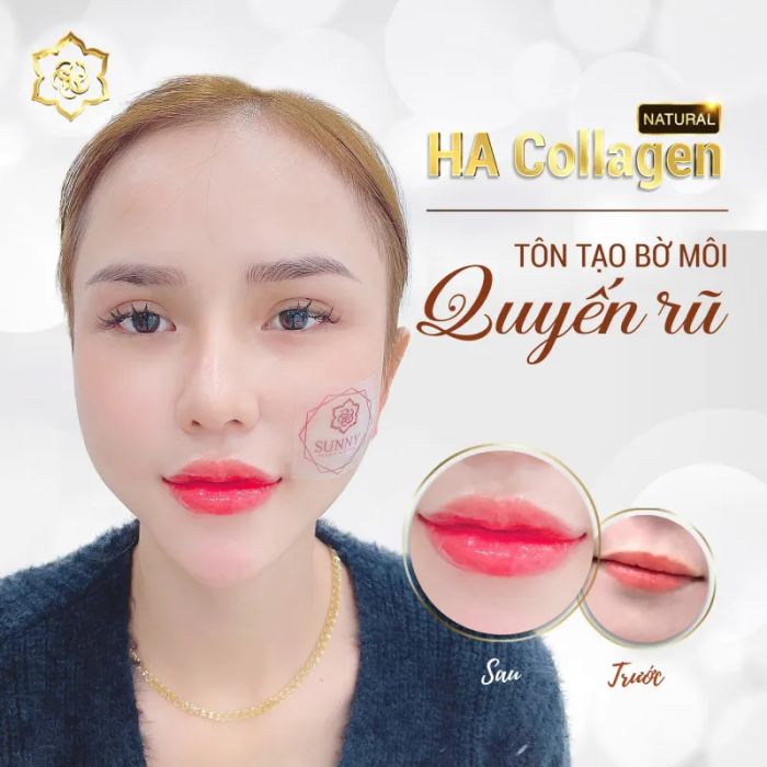 Hình ảnh không gian sang trọng tại SUNNY Beauty & Clinic