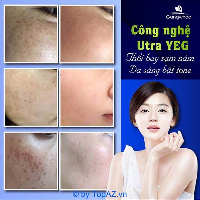 Địa chỉ thẩm mỹ chuẩn y khoa hàng đầu tại Thủ Dầu Một, Bình Dương