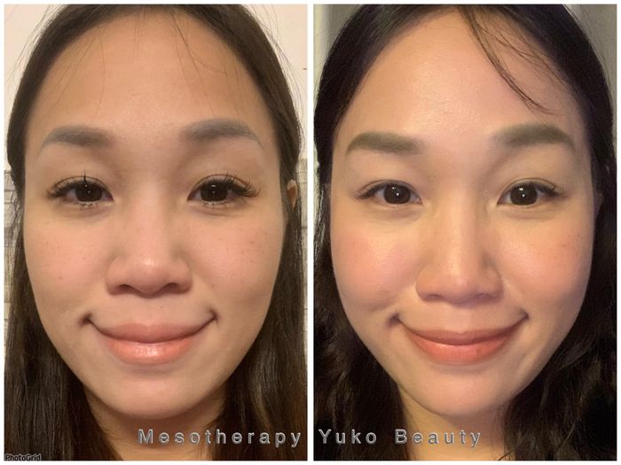 Hình ảnh Yuko Spa 2