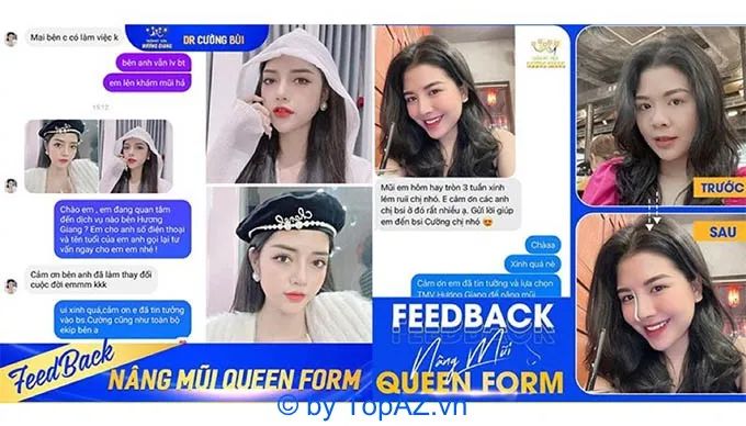 Cảm nhận chân thực từ khách hàng đã trải nghiệm nâng mũi Queenform cùng Ths.Bs Bùi Văn Cường