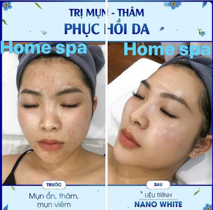 Hình ảnh Home Spa 2