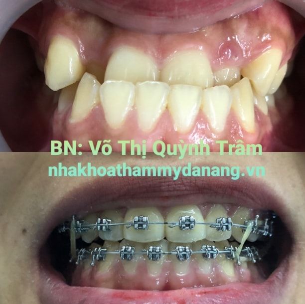 Hình ảnh phòng khám tiêu chuẩn tại Nha Khoa Thẩm Mỹ Đà Nẵng