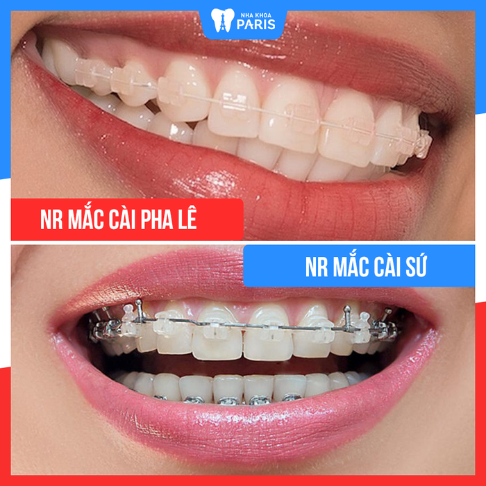 Hình ảnh không gian hiện đại tại Nha Khoa Paris Đà Nẵng